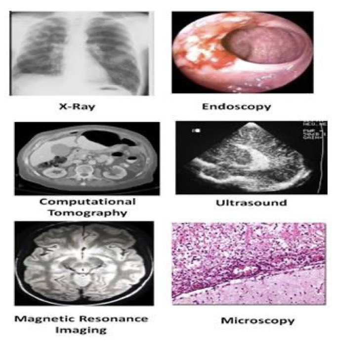 Multiple Types of Cancer Classification Using CT/MRI Images Based on Learning Without Forgetting Powered Deep Learning Models
