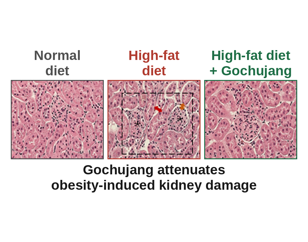Despite Its High Salt Content, Gochujang Attenuates Obesity-Induced Inflammatory Kidney Damage in Association With Gut Microbiota Modulation
